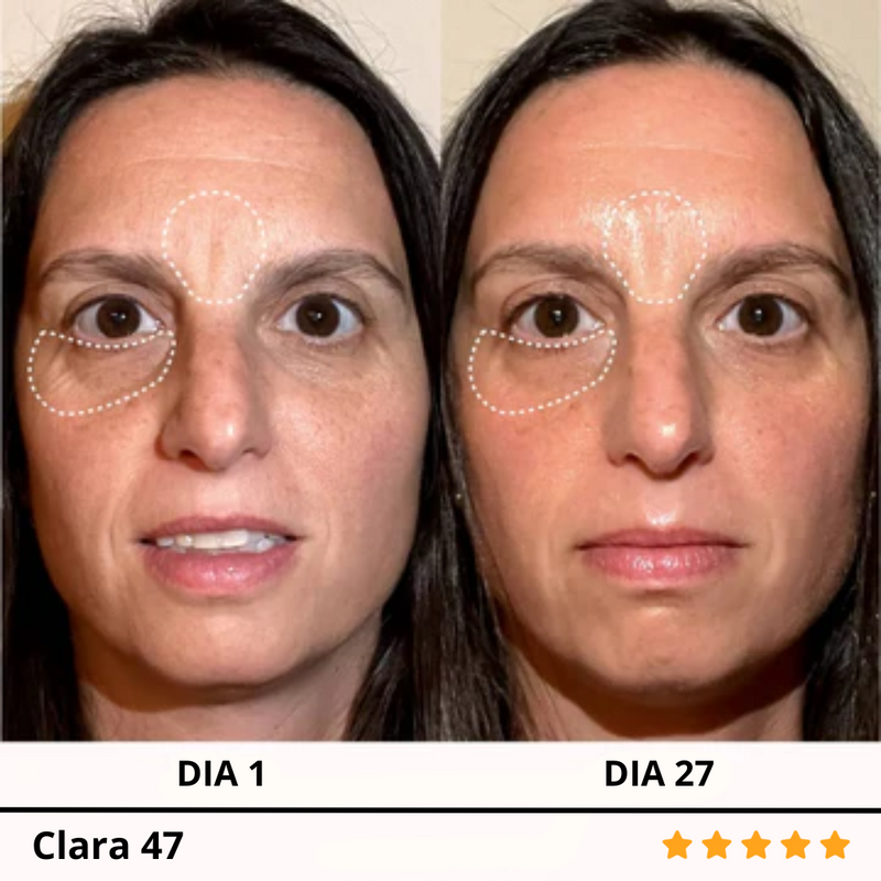 VitaGlow™ + Set 2 en 1 Serum Aguacate + E-Book GRATIS
