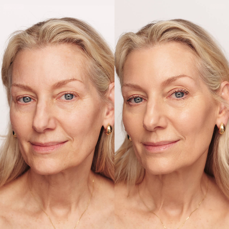 Lumine™ -Rejuvenece tu rostro al instante