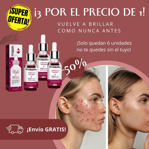 PerfectSkin™ - La Fórmula Única para una Piel Sin Acné ni Manchas
