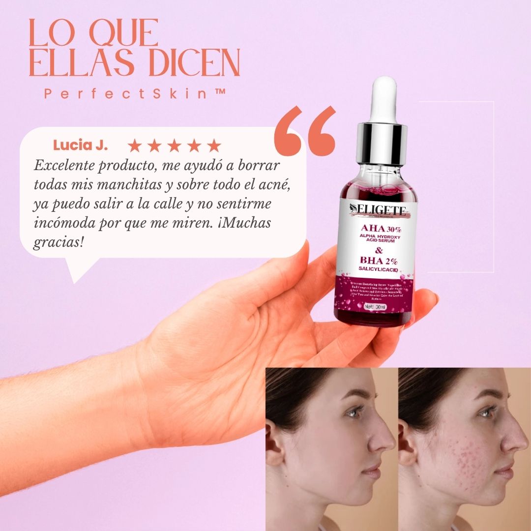 PerfectSkin™ - La Fórmula Única para una Piel Sin Acné ni Manchas