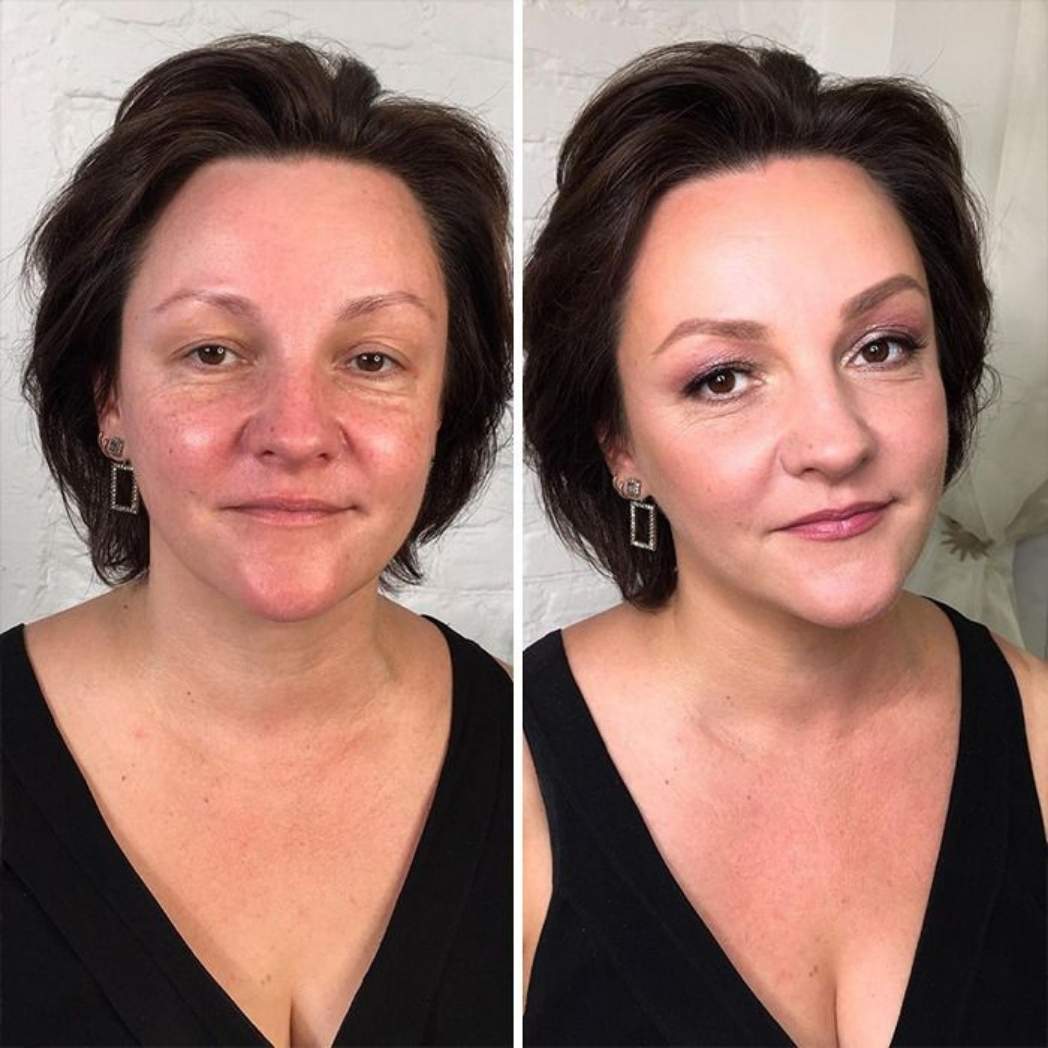 Lumine™ -Rejuvenece tu rostro al instante