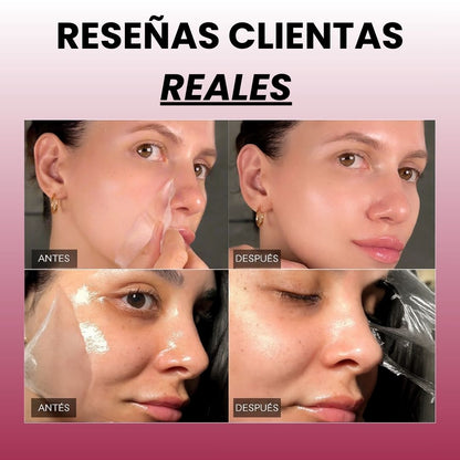 CristalSkin™ Rejuvenece tu piel un 90% desde la primera aplicación — 100% GARANTIZADO