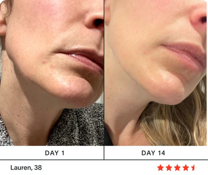 Dragon Essence™ + Serum RetinGlow™+ E-Book GRATIS