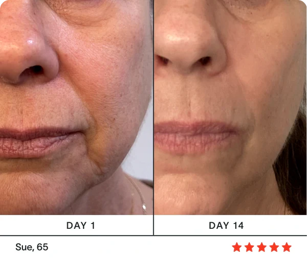 Dragon Essence™ + Serum RetinGlow™+ E-Book GRATIS